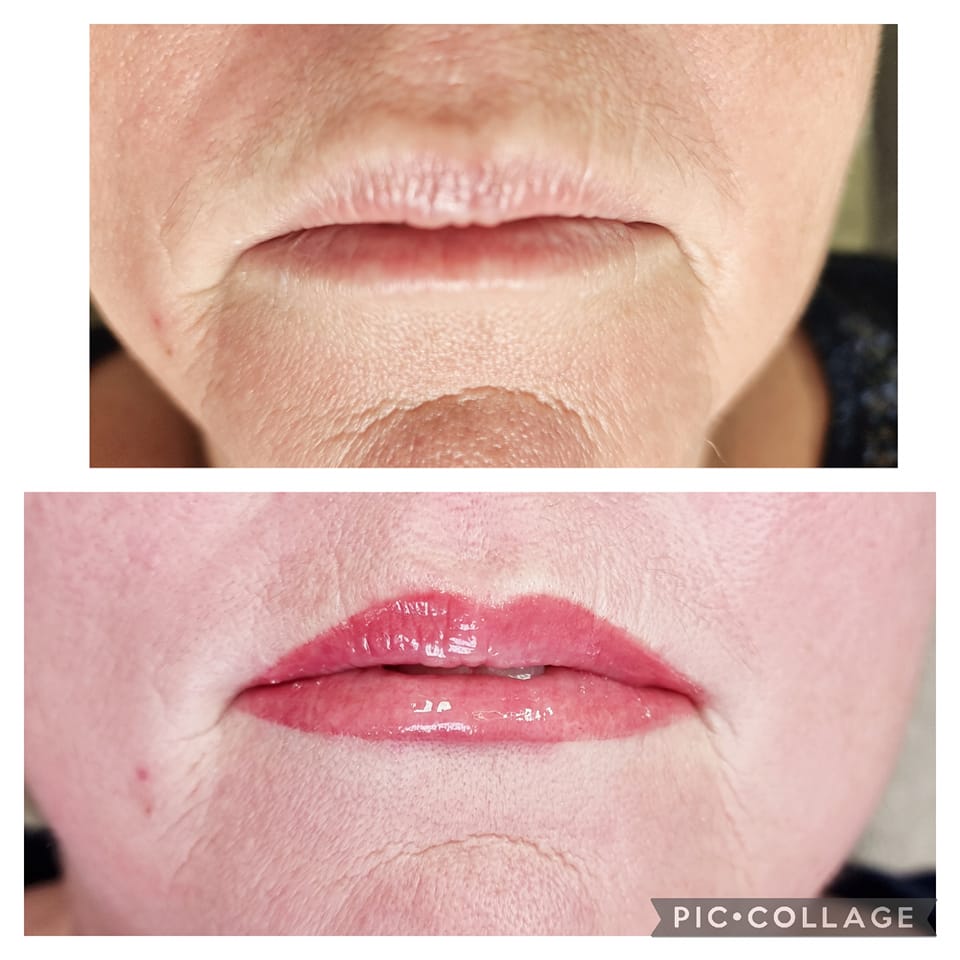 Lips Permanent makeup - Save time, enhance your features, and enjoy waterproof, smudge-proof results with long-lasting cosmetic tattooing.